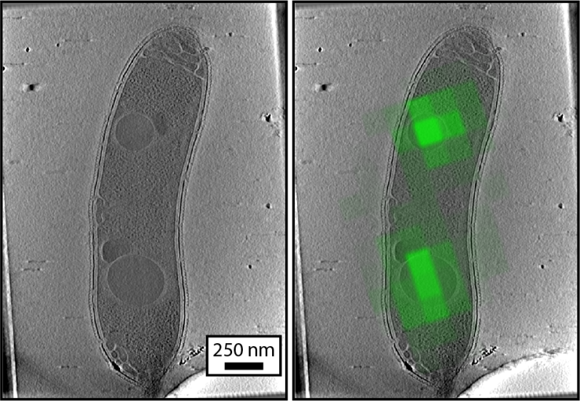 Example of diffraction limited CLEM using PhaC-GFP